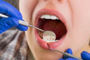 Sedation Dental Procedure