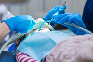 Sedation Dental Procedure