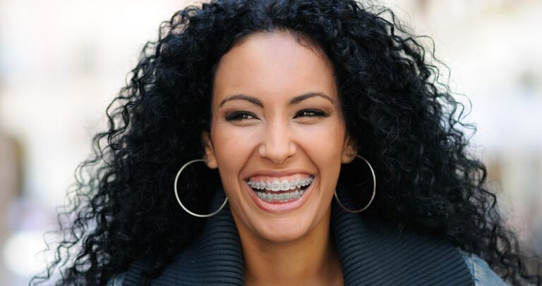 woman smiling with metal braces on teeth.