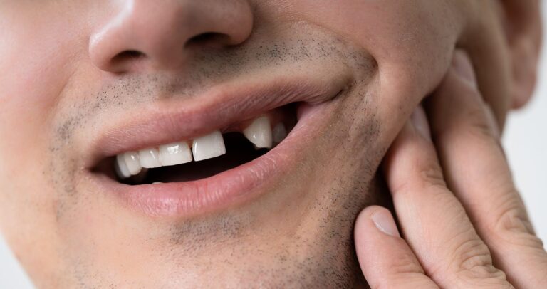 Man with missing tooth experiencing jaw pain.