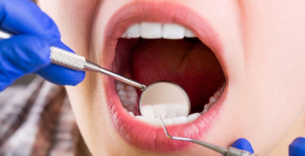 How To Prevent Tooth Decay