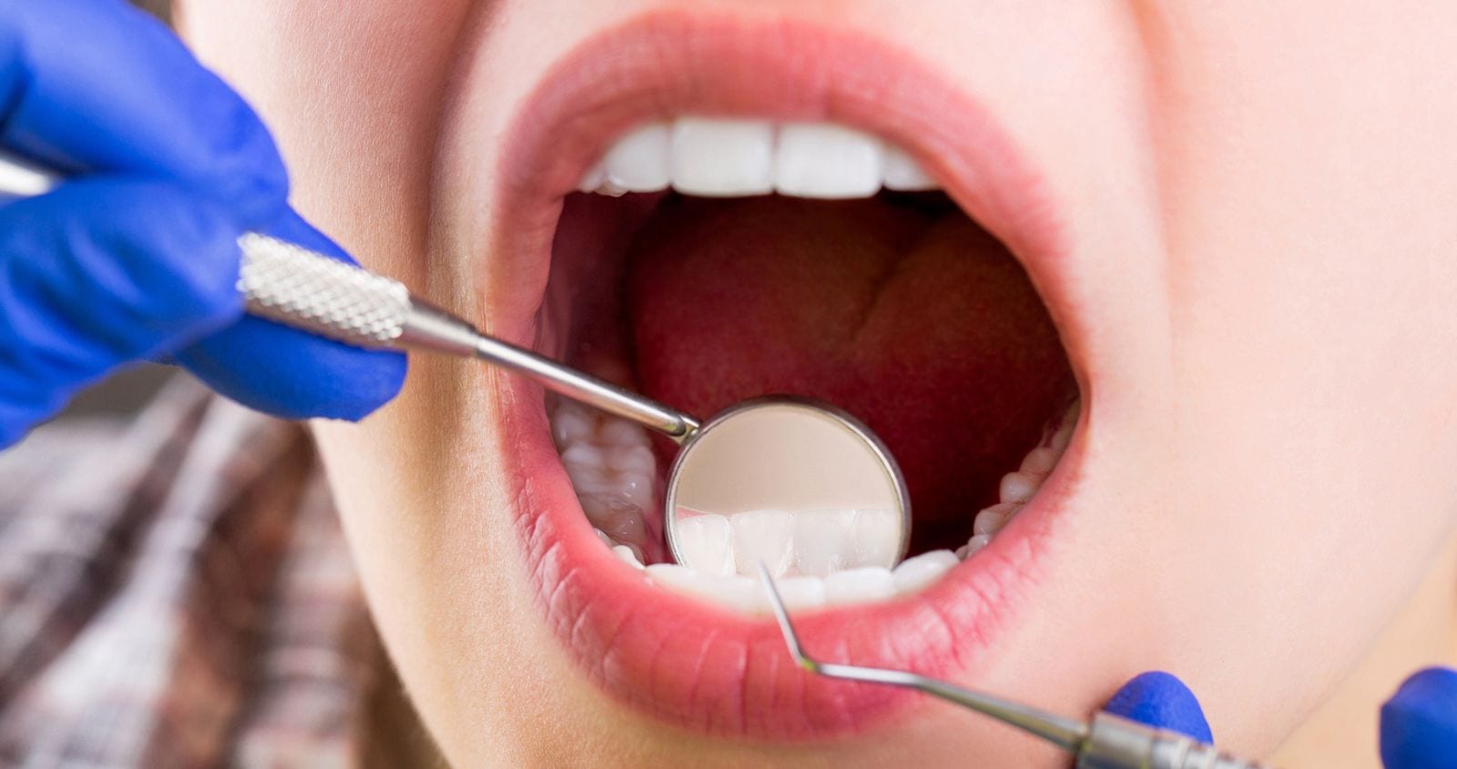 How To Prevent Tooth Decay