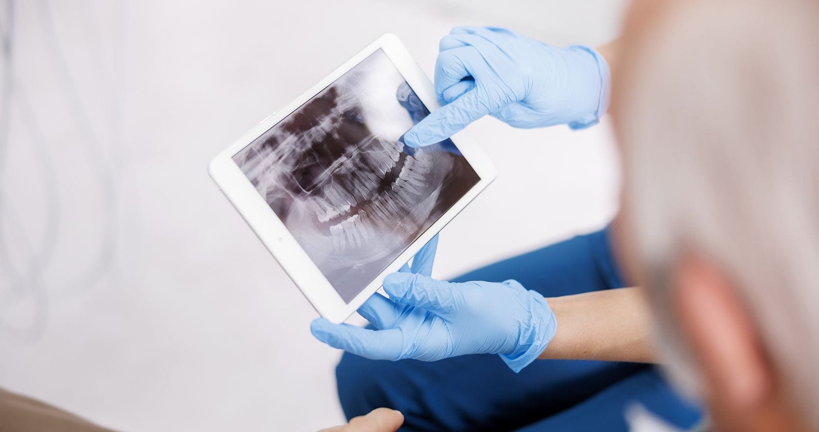 x-rays-are-vital-for-prevantative-dental-care